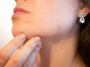 Reparación dermatológica