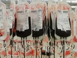 Reparación de calentador de sangre y líquidos