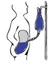 Infusion