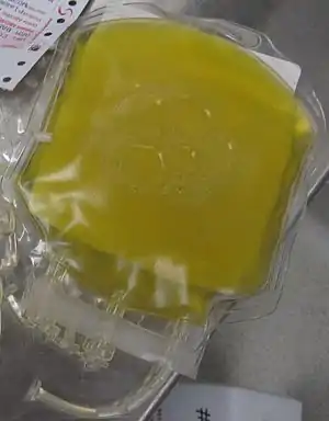 Photograph of a bag containing one unit of fresh frozen plasma