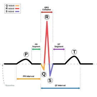 Normal sinus rhythm/EKG