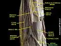 A dissection of the cubital fossa (inner elbow), labelling the median cubital vein.