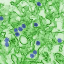 Electron micrograph of "Zika virus". Virus particles (digitally colored purple) are 40 nm in diameter, with an outer envelope and a dense inner core.