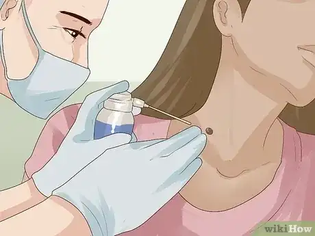 صورة عنوانها Get Rid of Skin Tags Step 3