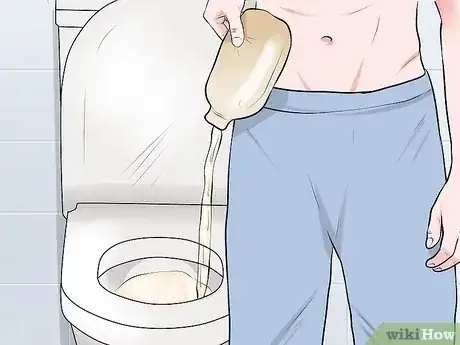 صورة عنوانها Change a Colostomy Bag Step 1