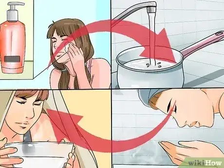 صورة عنوانها Get Rid of Acne Naturally Step 7