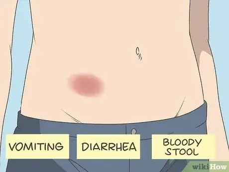 صورة عنوانها Dissolve Blood Clots Step 1