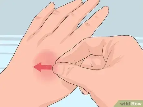 صورة عنوانها Cure Insect Stings Step 2