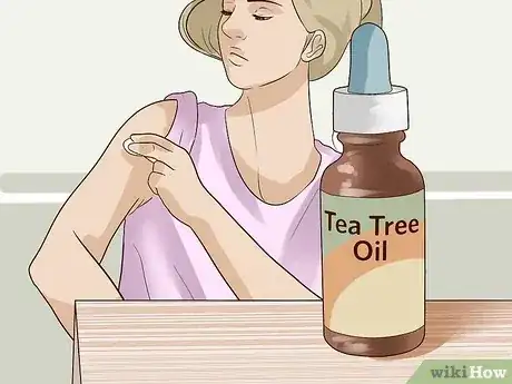 صورة عنوانها Get Rid of Skin Tags Step 9