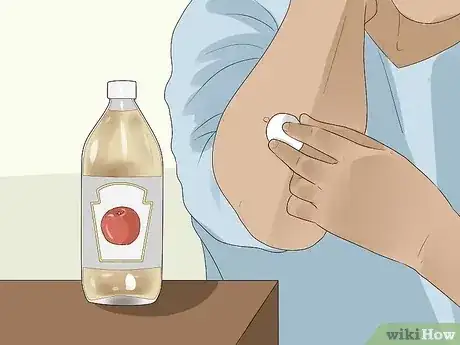صورة عنوانها Get Rid of Skin Tags Step 13