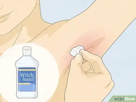 صورة عنوانها Reduce Redness After Waxing Step 9