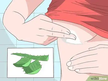 صورة عنوانها Get Rid of a Rash Under Breasts Step 5