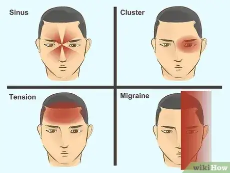 صورة عنوانها Treat a Migraine Step 1
