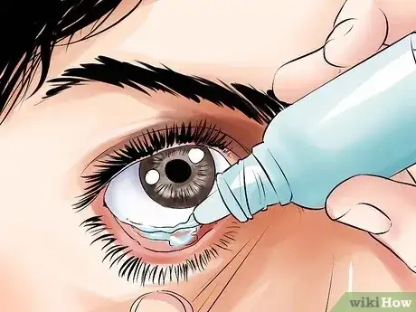 صورة عنوانها Heal a Scratched Cornea Step 15