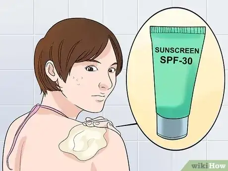 صورة عنوانها Remove Keloid Scars at Home Step 2