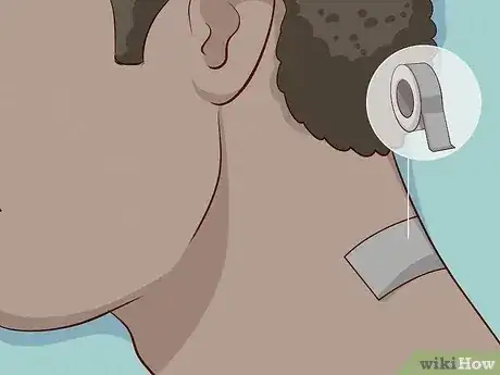صورة عنوانها Remove a Skin Tag from Your Neck Step 21