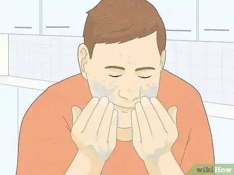 Gambar berjudul Get Clear Skin in 1 Week Step 6