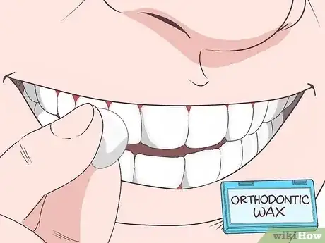 Gambar berjudul File Down a Sharp Tooth Step 9