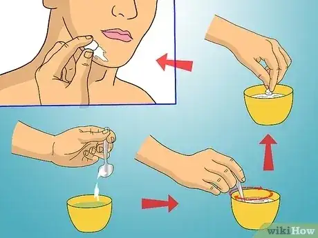 Gambar berjudul Get Rid of Razor Burn Fast Step 4