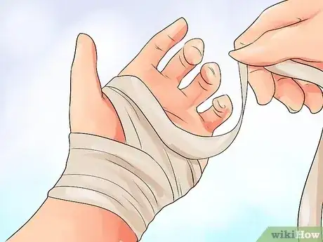 Gambar berjudul Exercise After Carpal Tunnel Surgery Step 7
