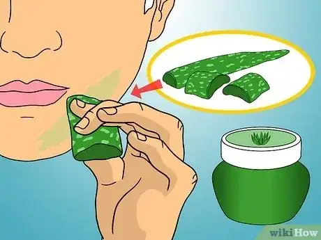 Gambar berjudul Get Rid of Razor Burn Fast Step 3