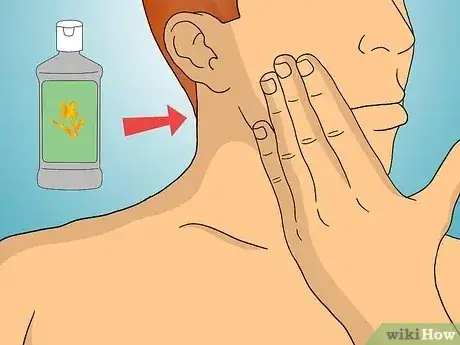 Gambar berjudul Get Rid of Razor Burn Fast Step 7