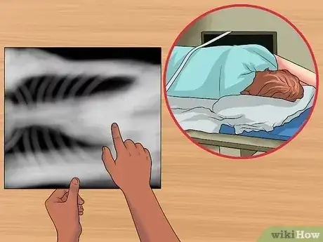Gambar berjudul Read a Chest X Ray Step 10