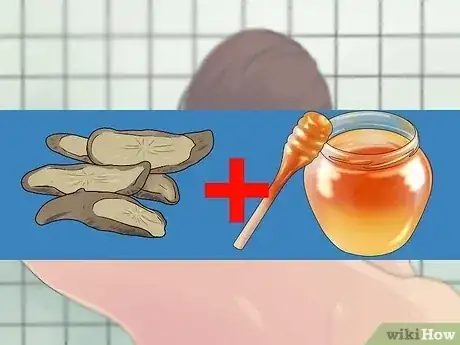 Gambar berjudul Remove a Sebaceous Cyst Step 9