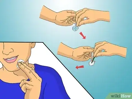 Gambar berjudul Get Rid of Razor Burn Fast Step 5