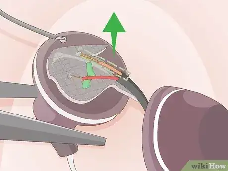 Gambar berjudul Fix Earbuds Step 7