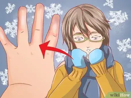 Gambar berjudul Recognize Frostbite Step 8