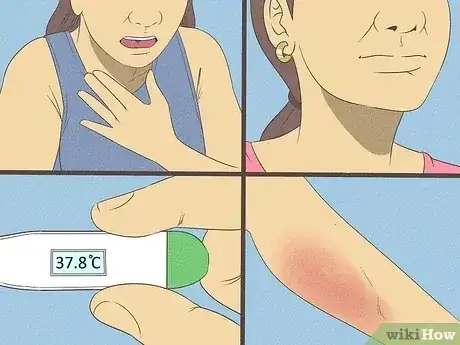 Gambar berjudul Get Rid of a Rash Step 12