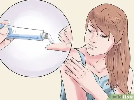 Gambar berjudul Get Rid of a Skin Rash Caused by Antibiotic Allergy Step 11