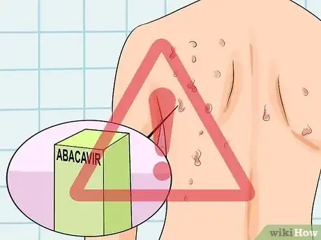 Gambar berjudul Identify an HIV Rash Step 4