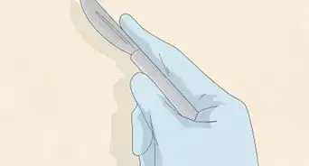 Memperbaiki Gigi Tonggos (Overbite)
