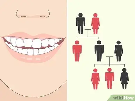 Gambar berjudul Fix an Uneven Smile Step 1