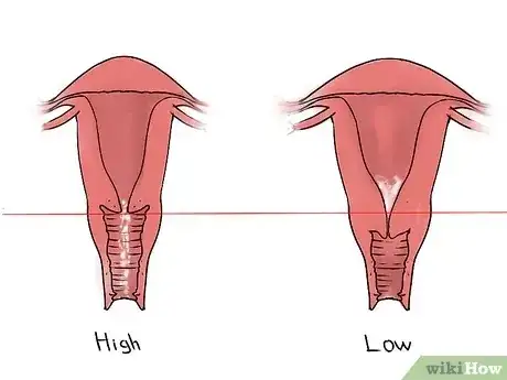 Gambar berjudul Feel Your Cervix Step 6