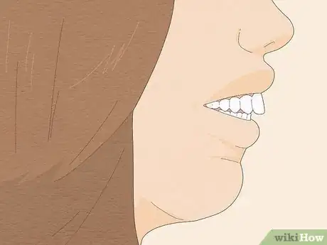 Imagem intitulada Fix an Overbite Step 1