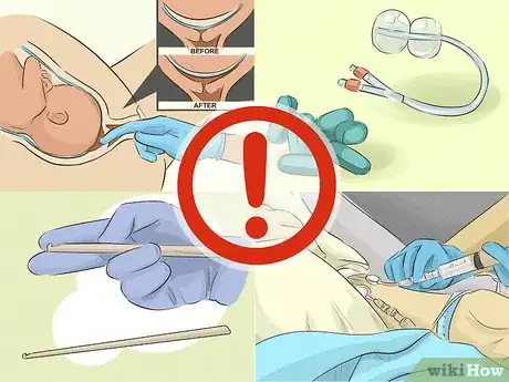Imagem intitulada Go Into Labor Early Step 9