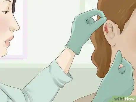 Imagem intitulada Clean an Infected Ear Piercing Step 8