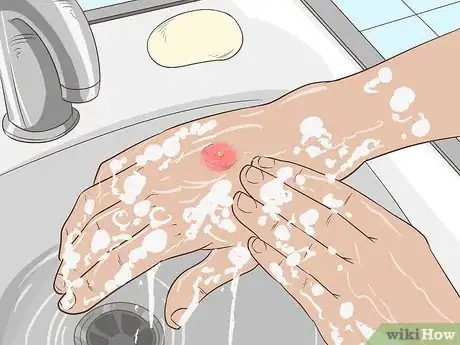 Imagem intitulada Get Rid of an Abscess Step 4