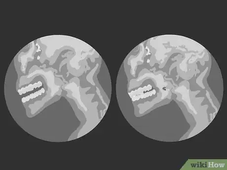 Imagem intitulada Stop Sounding Nasal Step 17