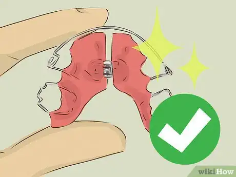 Imagem intitulada Clean Your Retainer Step 11