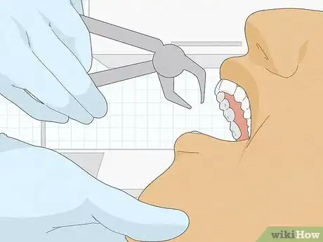 Imagem intitulada Fix an Overbite Step 6