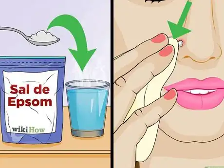 Imagem intitulada Tell if a Piercing Is Infected Step 13