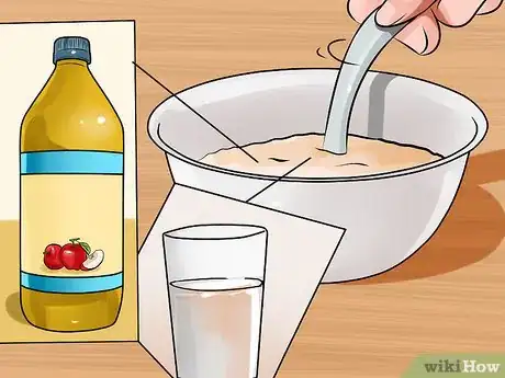 Imagem intitulada Cure Vaginal Infections Without Using Medications Step 16