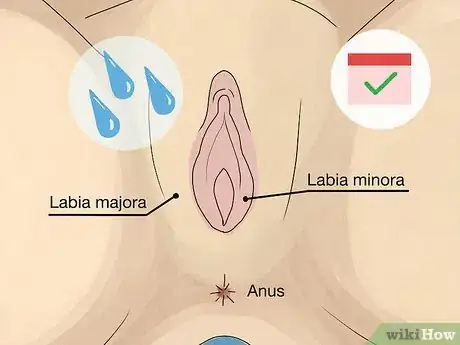 Imagem intitulada Control Vaginal Discharge Step 3