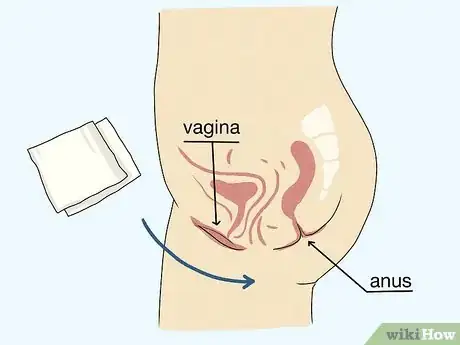 Imagem intitulada Control Vaginal Discharge Step 2