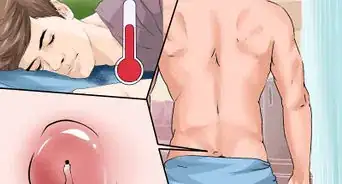 Tratar um Cisto Pilonidal