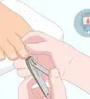 Aliviar a Dor de uma Unha Encravada